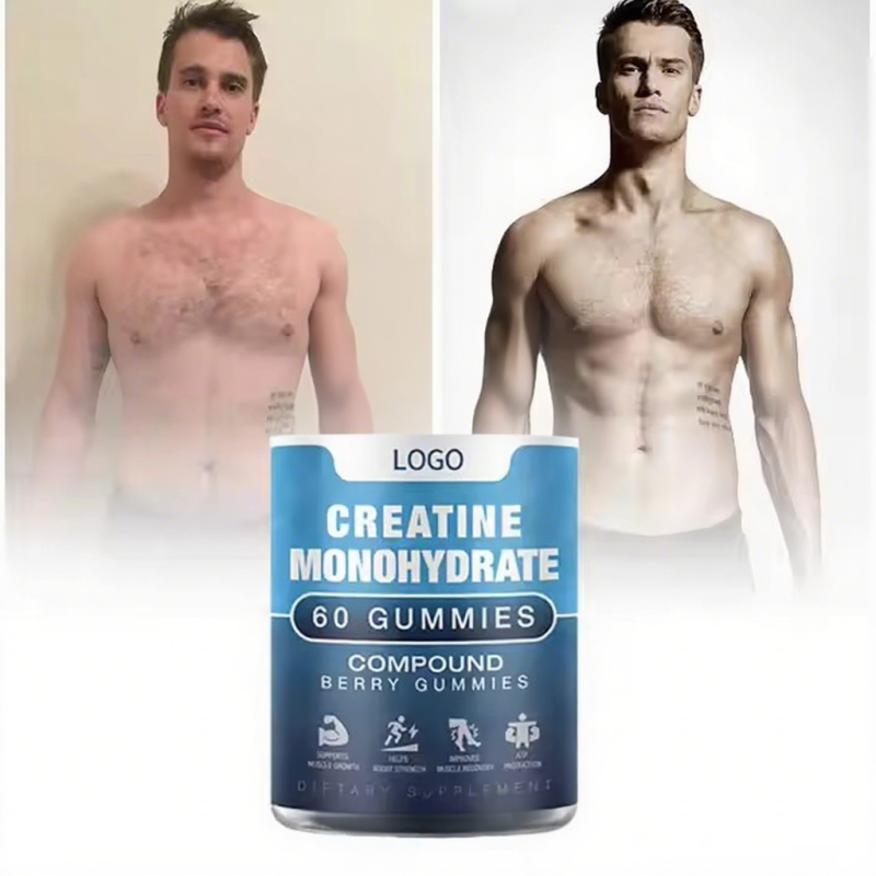 Creatine Gummies 15000mg Creatine Hydrochloride Supplements for Gym Muscle Growth Sports Nutrition Gummy Candy