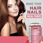 OEM Vegan Collagen & Biotin Gummies for Hair Growth - Beauty Skin Nails Supplement, Sugar-Free Chewable