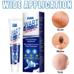 Wart Remover Supplier - Herbal Extract Corn Plaster Treatment Cream