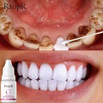 Teeth Whitening Serum Supplier - Herbal Plaque Removal Cleaning Liquid