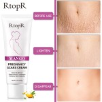 Pregnancy Mark Cream Factory - Mango Scars Acne Stretch Marks Treatment