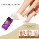 Athlete Foot Spray Factory - Beriberi Odor Peeling Deodorant Spray