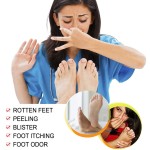 Athlete Foot Spray Factory - Beriberi Odor Peeling Deodorant Spray