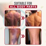 Bruise Spray Manufacturer - Muscle Strain Ankle Knee Pain Relief