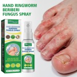 Foot Care Spray Manufacturer - Antifungal Smelly Feet Sweat Removal