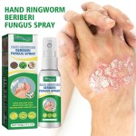 Foot Care Spray Manufacturer - Antifungal Smelly Feet Sweat Removal