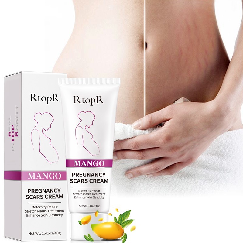 Pregnancy Mark Cream Factory - Mango Scars Acne Stretch Marks Treatment