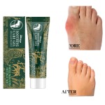 Joint Care Gel Supplier - Massage Gel for Knees Lumbar Pain