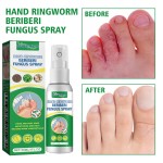 Foot Care Spray Manufacturer - Antifungal Smelly Feet Sweat Removal