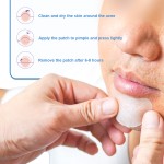 Hydrocolloid Face Patch Manufacturer - Factory OEM Private Label Gel