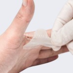 Hydrocolloid Bandage Factory - OEM Custom Heel Blister Patch Waterproof