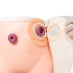 Ostomy Baseplate Manufacturer - 110mm Flat Colostomy Wafer Skin Barrier