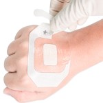 Transparent Wound Dressing Factory - Island Dressing IV Catheter Cover