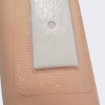 Hydrocolloid Dressing Manufacturer - OEM Custom for Pressure Ulcers Bulk