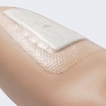 Hydrocolloid Dressing Manufacturer - OEM Custom for Pressure Ulcers Bulk