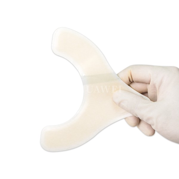 Ostomy Barrier Strips Manufacturer - Wholesale Leak Proof Hydrocolloid
