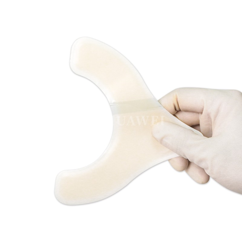 Ostomy Barrier Strips Manufacturer - Wholesale Leak Proof Hydrocolloid