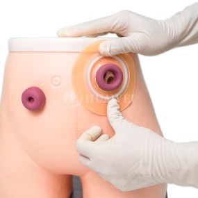 Ostomy Wafer Manufacturer - Wholesale Hydrocolloid Base Plate Skin