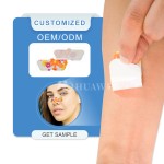 Blackhead Removal Strips Factory - Free Sample OEM Charcoal Nose Patch