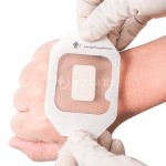 Transparent Wound Dressing Factory - Island Dressing IV Catheter Cover