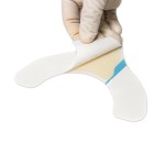 Ostomy Barrier Strips Manufacturer - Wholesale Leak Proof Hydrocolloid