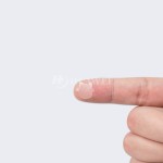 Acne Patches Manufacturer - CE Certified OEM Customizable Pimple Band