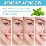 Acne Gel Supplier - 20g Dark Spot Remover Whitening