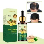 Hair Growth Serum Factory - Men Women Loss Prevention