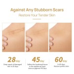 Scar Cream Supplier - Pimple Scar Removal Smooth Skin