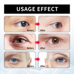 Eye Cream Factory - Anti Wrinkle Bags Removal