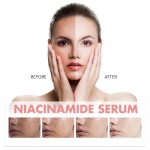 Spot Serum Factory - Nicotinamide Tone Equalizing