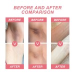 Whitening Gel Manufacturer - Armpit Intimate Area Lightening