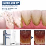 Teeth Whitening Spray Factory - Jaysuing Dental Calculus Dissolving Oral