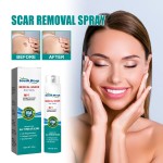 Scar Removal Spray Manufacturer - South Moon Fade Scar Skin Repair