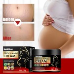 Stretch Mark Cream Factory - South Moon Postpartum Scar Removal Women