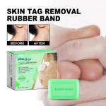 Handmade Soap Manufacturer - South Moon Brightening Acne Wart Removal