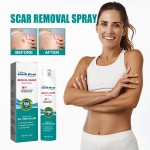 Scar Removal Spray Manufacturer - South Moon Fade Scar Skin Repair