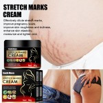 Stretch Mark Cream Factory - South Moon Postpartum Scar Removal Women