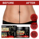 Stretch Mark Cream Factory - South Moon Postpartum Scar Removal Women