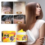 Sulfur Shampoo Manufacturer - South Moon Anti Dandruff Itchy Scalp Care