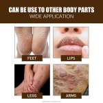 Anti-Crack Cream Factory - South Moon Heel Treatment Dry Skin Repair