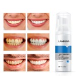 Teeth Whitening Mousse Manufacturer - LANBENA Stains Removal Foam Clean