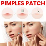 Acne Patch Manufacturer - Jaysuing Colorful Pimples Remover OEM