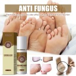 Foot Odor Spray Factory - Herbal Anti Fungal Deodorant Bad Smell Feet