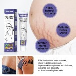 Stretch Mark Cream Factory - South Moon Mango Mark Remover Cream
