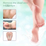 Exfoliating Foot Mask Factory - OEM Soft Smooth Gentle