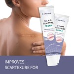Pregnancy Stretch Mark Cream Manufacturer - Repair Scar Removal Acne Cream
