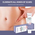 Pregnancy Stretch Mark Cream Manufacturer - Repair Scar Removal Acne Cream