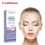 Pregnancy Stretch Mark Cream Manufacturer - Repair Scar Removal Acne Cream