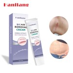 Pregnancy Stretch Mark Cream Manufacturer - Repair Scar Removal Acne Cream